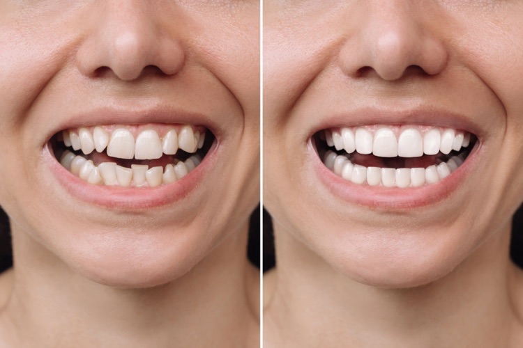 cosmetic dentistry examples