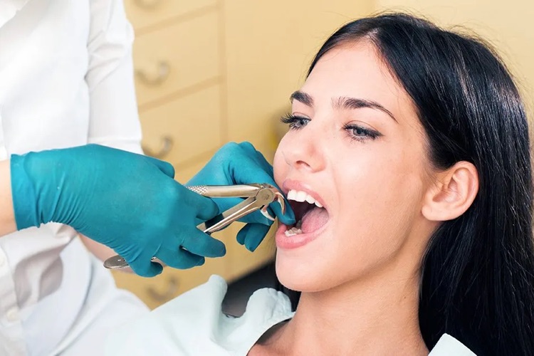 can i drink coffee after tooth extraction